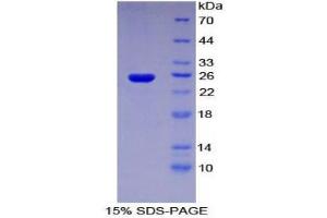 SDS-PAGE (SDS) image for Sprouty Homolog 3 (SPRY3) (AA 91-288) protein (His tag) (ABIN2126835)