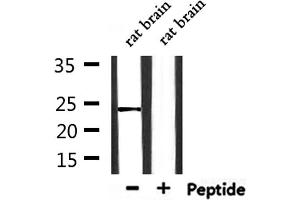 Western blot analysis of extracts from rat brain, using CLDN20 Antibody. (Claudin 20 antibody  (C-Term))