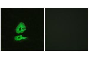 Immunofluorescence analysis of HeLa cells, using GLR antibody. (GLRa2 antibody  (Internal Region))
