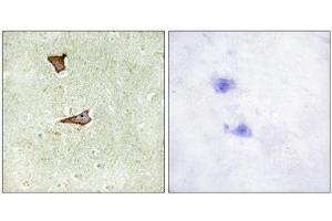 Immunohistochemistry (IHC) image for anti-Insulin-Like Growth Factor 2 Receptor (IGF2R) (pSer2409) antibody (ABIN1847437) (IGF2R antibody  (pSer2409))