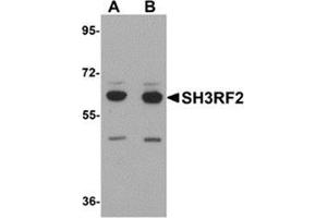Western blot analysis of SH3RF2 in 3T3 cell lysate with SH3RF2 antibody at (A) 1 and (B) 2 μg/ml.