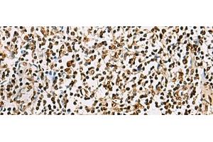 Immunohistochemistry of paraffin-embedded Human tonsil tissue using FOXI1 Polyclonal Antibody at dilution of 1:55(x200) (FOXI1 antibody)