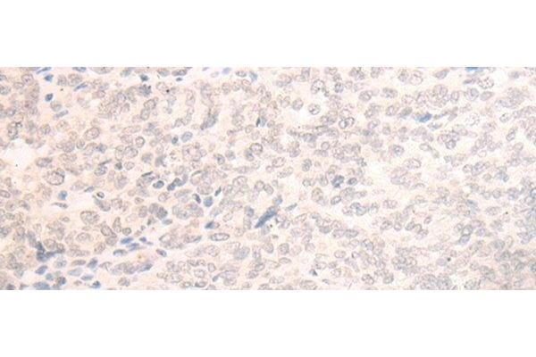 EME2 antibody