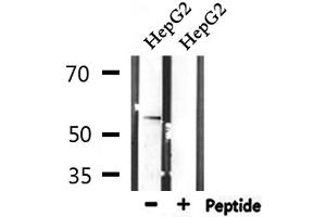 Western blot analysis of extracts from HepG2, using STK38L Antibody. (STK38L antibody  (C-Term))
