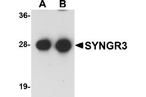 Western Blotting (WB) image for anti-Synaptogyrin 3 (SYNGR3) (C-Term) antibody (ABIN1030716) (Synaptogyrin 3 antibody  (C-Term))