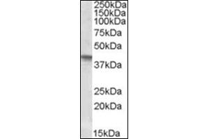 Image no. 1 for anti-Secreted Frizzled-Related Protein 4 (SFRP4) (Internal Region) antibody (ABIN375089) (SFRP4 antibody  (Internal Region))