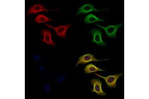 ABIN6256912 and ABIN6274865 staining Hela cells by IF/ICC.
