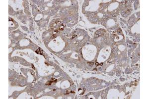 IHC-P Image Immunohistochemical analysis of paraffin-embedded NCI-N87 xenograft, using ESE1 , antibody at 1:100 dilution. (ELF3 antibody  (C-Term))