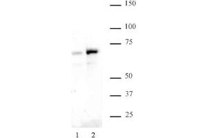 NFκB p65 phospho Ser529 pAb tested by Western blot. (NF-kB p65 antibody  (pSer529))