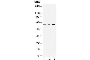 Western blot testing of 1) rat skeletal muscle, 2) mouse skeletal muscle and 3) human A549 lysate with Catalase antibody. (Catalase antibody)