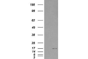 HEK293 overexpressing SH2D1A and probed with ABIN2559907 (mock transfection in first lane). (SH2D1A antibody  (Internal Region))
