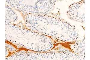 ABIN6267072 at 1/100 staining mouse testis tissue sections by IHC-P. (JAK1 antibody  (pTyr1022, pTyr1023))
