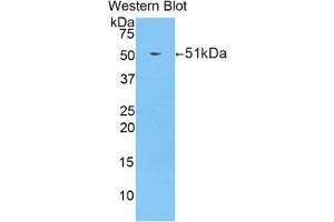 Western Blotting (WB) image for anti-Protease, serine, 8 (PRSS8) (AA 124-342) antibody (ABIN1860330) (PRSS8 antibody  (AA 124-342))