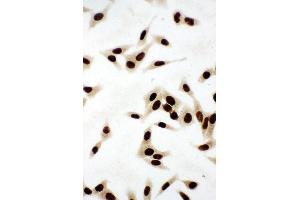 Anti-Ku80 antibody,  ICC ICC: HELA Cell (XRCC5 antibody  (C-Term))