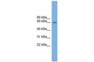 Image no. 1 for anti-Nuclear Receptor Subfamily 4, Group A, Member 3 (NR4A3) (AA 551-600) antibody (ABIN6744584) (NR4A3 antibody  (AA 551-600))