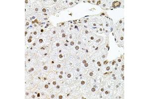 Immunohistochemistry of paraffin-embedded mouse liver using U2SURP antibody (ABIN6132839, ABIN6149759, ABIN6149760 and ABIN6220240) at dilution of 1:100 (40x lens). (SR140 antibody  (AA 705-1029))
