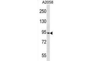 Western Blotting (WB) image for anti-Prospero Homeobox 1 (PROX1) antibody (ABIN3001421) (PROX1 antibody)