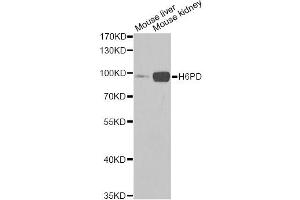 Western blot analysis of extracts of various cell lines, using H6PD Antibody (ABIN5973840) at 1/1000 dilution. (Glucose-6-Phosphate Dehydrogenase antibody)