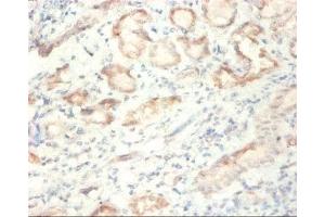 Immunohistochemistry of paraffin-embedded human kidney tissue using ABIN7170886 at dilution of 1:50 (SDHA antibody  (AA 44-664))