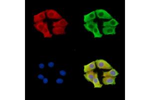 ABIN7096615 and ABIN7100679 staining HepG2 cells by IF/ICC. (ARMC9 antibody)