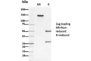 SDS-PAGE Analysis Purified APC Mouse Monoclonal Antibody (ALi 12-28). (APC antibody  (AA 1-433))