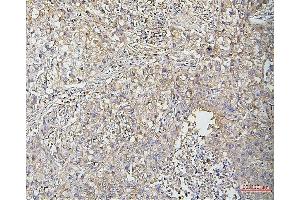 IHC analysis of Cofilin-2 using anti-Cofilin-2 antibody (ABIN7602747). (Cofilin 2 antibody  (C-Term))