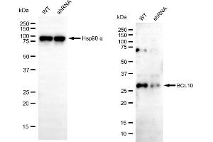 Western blotting analysis using BCL10 antibody (ABIN7800914).
