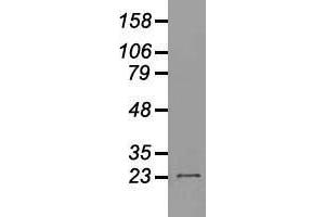 Western blot analysis of 35 µg of cell extracts from human (HeLa) cells using anti-NEUROG1 antibody. (Neurogenin 1 antibody)