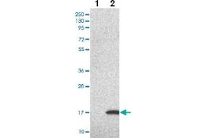 Western blot analysis of Lane 1: Negative control (vector only transfected HEK293T lysate) Lane 2: Over-expression Lysate (Co-expressed with a C-terminal myc-DDK tag (~3. (LSM5 antibody)