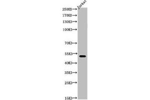 Western Blot analysis of Jurkat cells using Acetyl-Tubulin α (K40) Polyclonal Antibody (TUBA1A antibody  (acLys402))