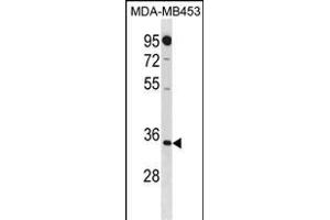 MT Antibody (N-term) 20271a western blot analysis in MDA-M cell line lysates (35 μg/lane). (MTAP antibody  (N-Term))