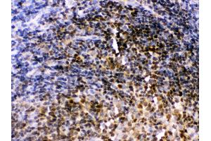 Anti- Pax2 Picoband antibody,IHC(P) IHC(P): Rat Lymphaden Tissue (PAX2A antibody  (C-Term))
