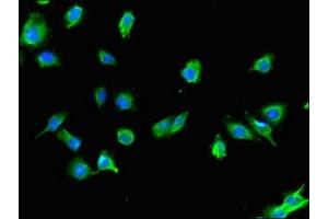 Immunofluorescent analysis of U251 cells using ABIN7175459 at dilution of 1:100 and Alexa Fluor 488-congugated AffiniPure Goat Anti-Rabbit IgG(H+L) (UBE2Z antibody  (AA 1-146))