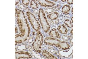 Immunohistochemistry of paraffin-embedded rat kidney using Adenylate kinase 4 Rabbit mAb (ABIN7265467) at dilution of 1:100 (40x lens). (AK4 antibody)