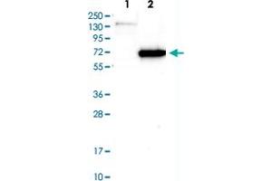 Western blot analysis of Lane 1 : Negative control (vector only transfected HEK293T lysate), Lane 2: Over-expression lysate (Co-expressed with a C-terminal myc-DDK tag (~3. (AKT1 antibody)