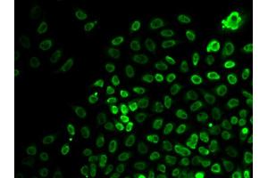 Immunofluorescence analysis of HeLa cells using SMARCA4 antibody. (SMARCA4 antibody)