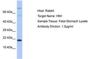 Image no. 1 for anti-Hematological and Neurological Expressed 1 (HN1) (C-Term) antibody (ABIN6750353)