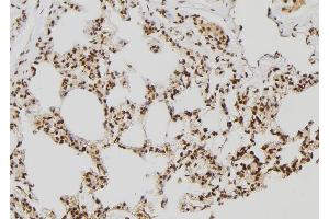 ABIN6277645 at 1/100 staining Rat lung tissue by IHC-P. (RNF2 antibody  (Internal Region))