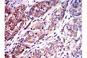 Immunohistochemistry (IHC) image for anti-Neurofilament, Light Polypeptide (NEFL) antibody (ABIN969548)