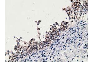 Image no. 2 for anti-Hydroxyprostaglandin Dehydrogenase 15-(NAD) (HPGD) antibody (ABIN1496361) (HPGD antibody)