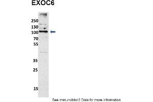 Sample Type: mouse fibroblast lusate (20ug)Primary Dilution: 1:1000 (2% milk)Secondary Dilution: 1:2000 (5% milk)Image Submitted By: Anonymous researcher . (EXOC6 antibody  (N-Term))