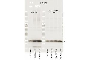 Immunoblotting. (MYL12A antibody  (pSer19, pSer20))
