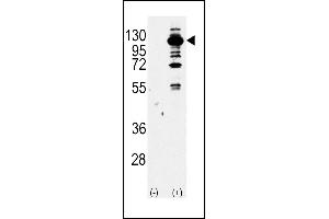 Western blot analysis of PI3KCG Antibody (Center) Pab (ABIN392817 and ABIN2842248) (arrow) using purified Pab. (PIK3 gamma antibody  (AA 518-547))
