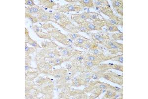 Immunohistochemistry of paraffin-embedded human liver using NUDT15 antibody.