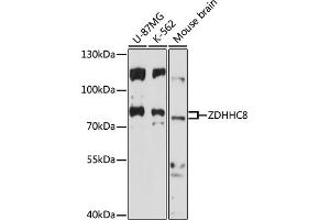 Western blot analysis of extracts of various cell lines, using ZDHHC8 antibody (ABIN7271556) at 1:1000 dilution. (ZDHHC8 antibody  (AA 240-380))