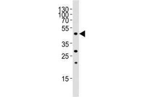 Western blot analysis of lysate from rat liver tissue, using FOXA2 antibody at 1:1000. (FOXA2 antibody  (C-Term))
