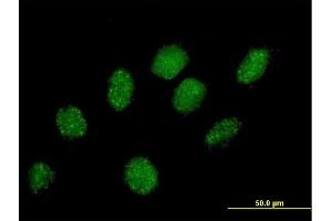 Immunofluorescence of purified MaxPab antibody to PRPF40A on HeLa cell. (PRPF40A antibody  (AA 1-215))