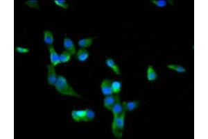 Immunofluorescence staining of SH-SY5Y cells with ABIN7172718 at 1:66, counter-stained with DAPI. (BACH2 antibody  (AA 136-235))