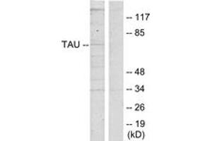 Western blot analysis of extracts from HeLa cells, using Tau (Ab-262) Antibody. (tau antibody  (AA 551-600))