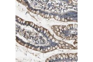 Immunohistochemical staining of human small intestine with SCN4B polyclonal antibody  shows moderate positivity in glandular cells. (SCN4B antibody)